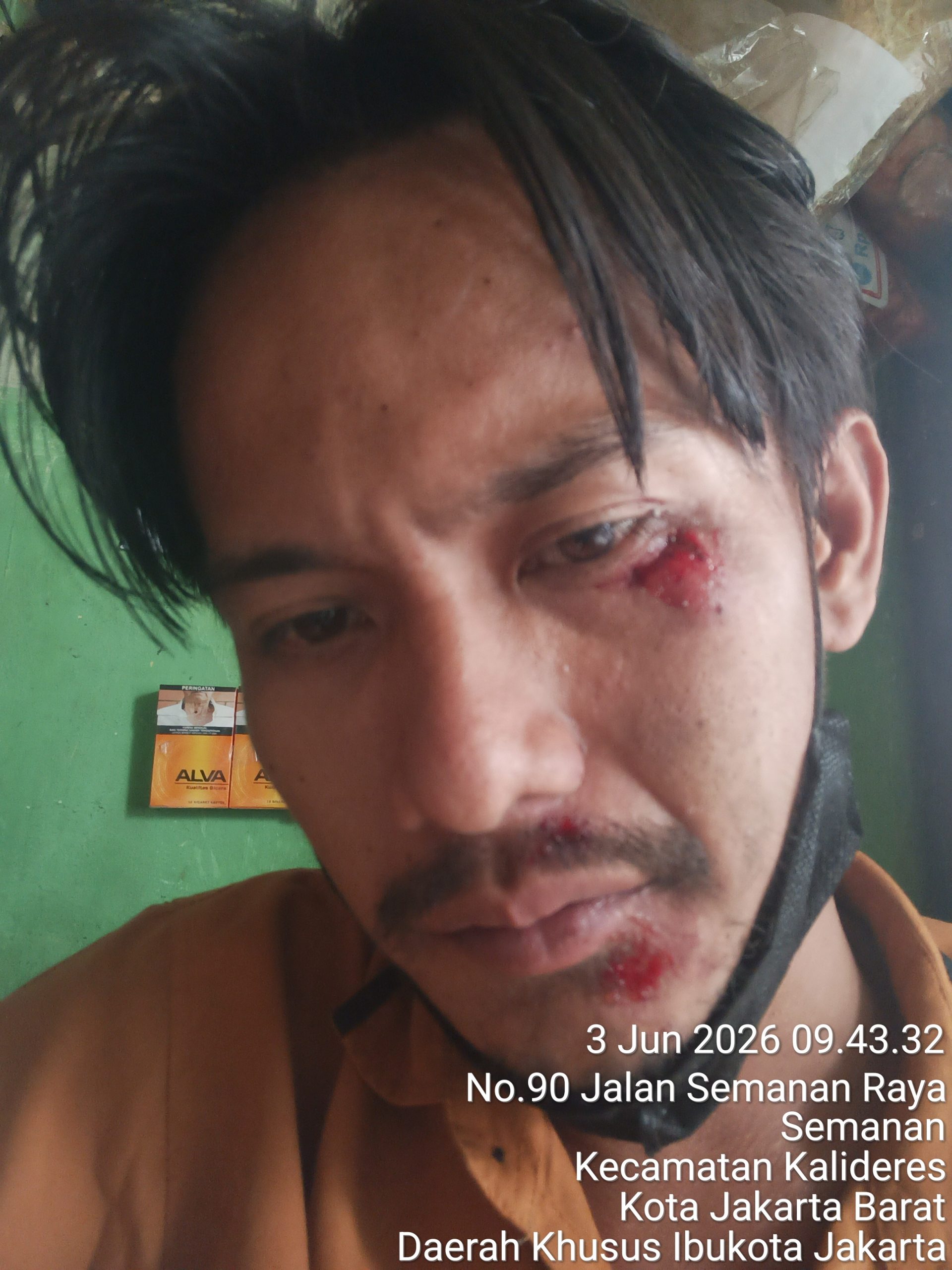 Enjel Rd Korwil DKi Jakarta Menjadi Korban Kecelakaan Dan Mengalami Luka Serius Di Bagian Wajah